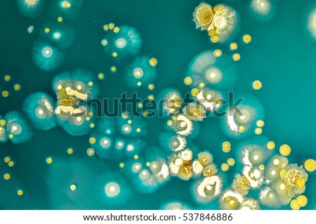 Colony characteristic of Actinomyces on selective media, Bacterial colony on agar plate media, Background of bacterial colony on plate, Background of microbiology
