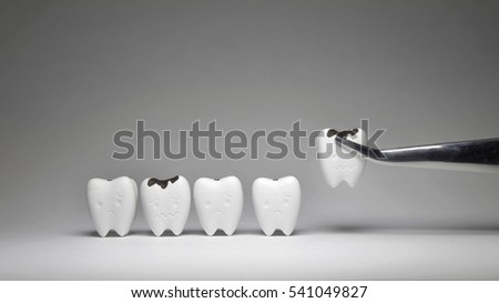 Decayed tooth model was pinch if don't brush the teeth every day, tooth will not unhealthy 2