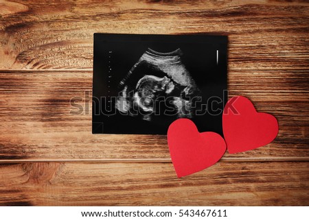 Ultrasound of baby on wooden background