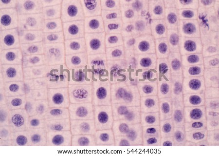 Root tip of Onion and Mitosis cell in the Root tip of Onion under a microscope.(soft focus) Royalty-Free Stock Photo #544244035