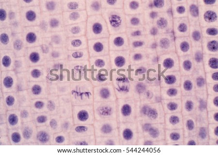 Root tip of Onion and Mitosis cell in the Root tip of Onion under a microscope.(soft focus) Royalty-Free Stock Photo #544244056