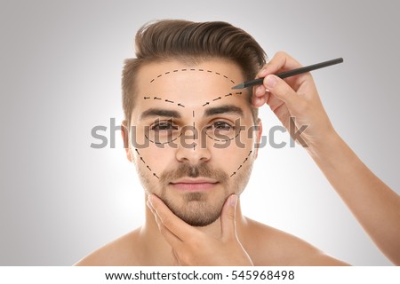 Surgeon drawing marks on male face against gray background. Plastic surgery concept Royalty-Free Stock Photo #545968498