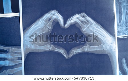 x-ray image of hands making heart symbols.