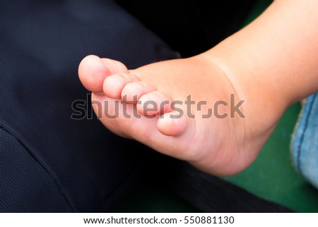 Little baby feet with fingers. Newborn child bare foot. Baby shower photo background. Cute little leg of small child. Sweet foot of a baby under year. Caucasian infant soft skin. Children body part