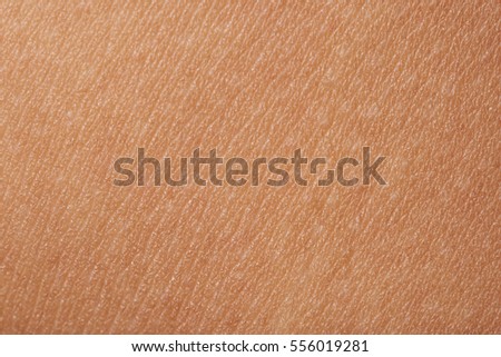 Macro of human skin with white dots. Human skin texture Royalty-Free Stock Photo #556019281