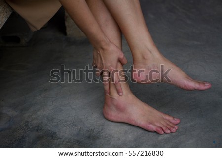 Hands of woman  touch clean red  foot that swelling /Bruises  / footsore/foot in pain/ injured foot / massaging foot / Bruises on foot 