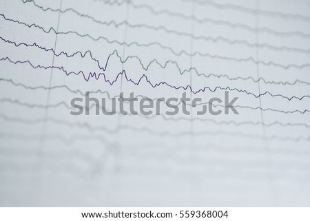 EEG report,abnormal EEG wave brain
