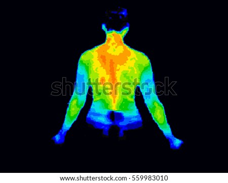 Thermographic image of the back of the upper body showing different temperature in a range of colors from blue showing cold to red showing hot which can indicate joint inflammation. Royalty-Free Stock Photo #559983010