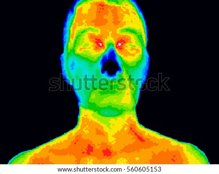 Thermographic image of a human face showing different temperatures in a range of colors from blue showing cold to red showing hot which can indicate inflammation. Royalty-Free Stock Photo #560605153