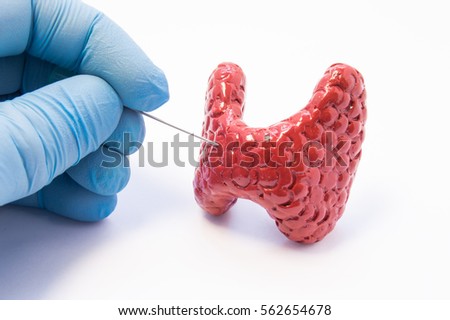 Biopsy of thyroid gland procedure. Doctor hold puncture needle in hand near anatomical 3D model of thyroid gland, ready to pierce its tissue. Concept photo for invasive diagnosis of thyroid disease