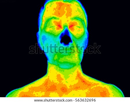 Thermographic image of a human face showing different temperatures in a range of colors from blue showing cold to red showing hot which can indicate inflammation. Royalty-Free Stock Photo #563632696