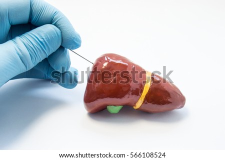 Concept photo of liver biopsy procedure. Hand surgeon holds puncture needle and is preparing to pierce anatomical 3D model of human liver. Diagnosis of liver diseases like hepatitis cirrosis by biopsy