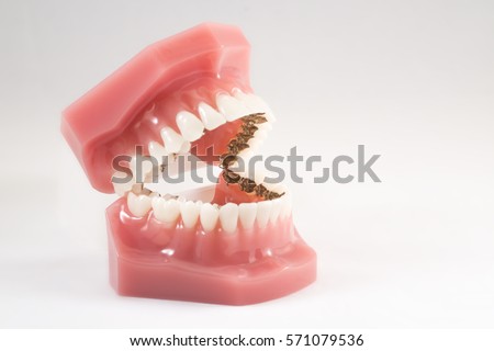 lingual orthodontics Royalty-Free Stock Photo #571079536
