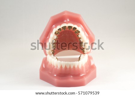 lingual orthodontics Royalty-Free Stock Photo #571079539