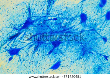 Science background- neuron tissue. Nerve fibers: motor neurous- study with a large increase in the structural and functional nerve system. Core cell body processes. Scientific- spinal cord Royalty-Free Stock Photo #571920481