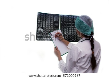 Doctor holding a picture of a brain MRI workflow in diagnostic hospital