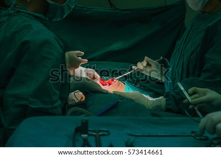 Blur image of teamwork during surgery in operating room