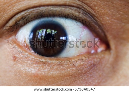 Close up dark brown eye.