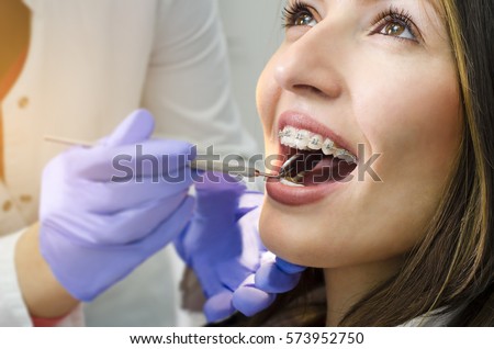 Closeup of beautiful girl on dental braces check up  Royalty-Free Stock Photo #573952750