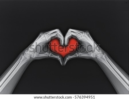 X-ray image of hands making heart symbols.Valentines day heart background.