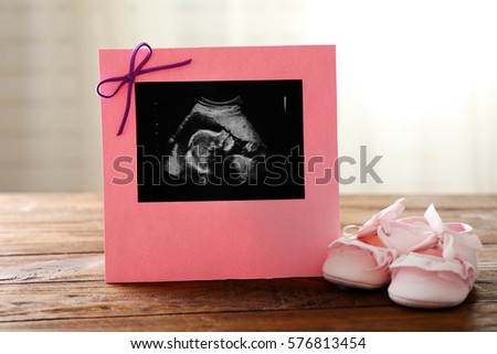 Ultrasound scan of baby in frame on wooden table