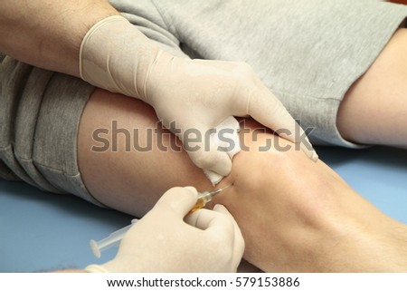 Platelet rich plasma PRP used in 
treatment of knee injuries Royalty-Free Stock Photo #579153886