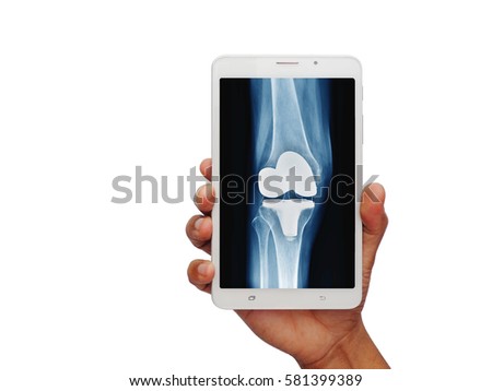 doctor's hand holding tablet / smart phone show knee joint replacement , Telemedicine , Medical technology concept