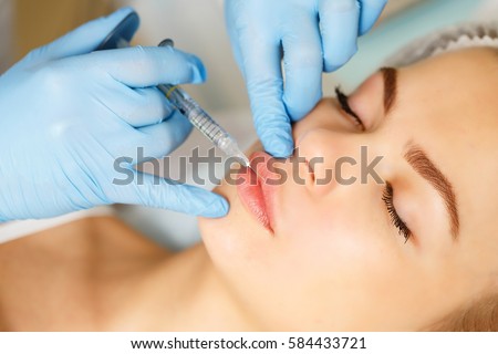 Injections of the lips. Correction form the upper lip. Injection of beauty. Spa. Facial Rejuvenation. Lip augmentation. Royalty-Free Stock Photo #584433721