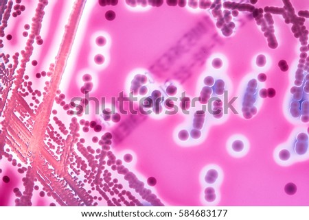 Close up of petri dish with colony of Streptococcus bacteria. Microscop look photo of bacteria in petri dish on colorful agar. Isolaten colonies of bacterias on agar medium.  Royalty-Free Stock Photo #584683177