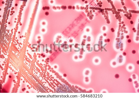 Close up of petri dish with colony of Streptococcus bacteria. Microscop look photo of bacteria in petri dish on colorful agar. Isolaten colonies of bacterias on agar medium.  Royalty-Free Stock Photo #584683210