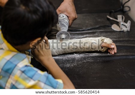 Cutting plaster from boy's hand.