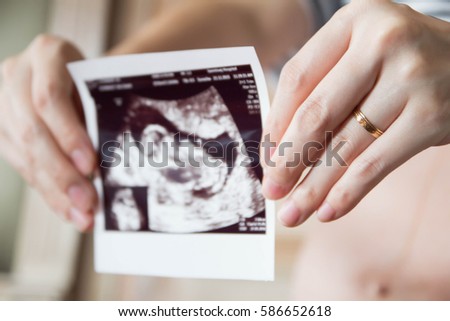 Close up of woman's hand with ring. Pregnant woman is holding her baby ultrasound scan