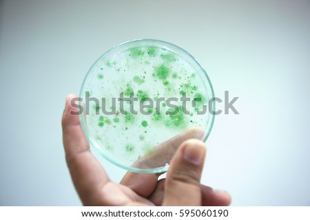 Colony of blue green algae in culture medium plate, Microbiology. Royalty-Free Stock Photo #595060190