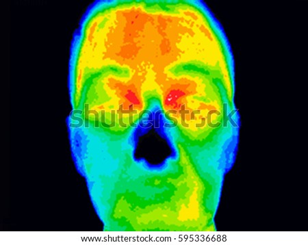 Thermographic image of a human face showing different temperatures in a range of colors from blue showing cold to red showing hot which can indicate inflammation. Royalty-Free Stock Photo #595336688