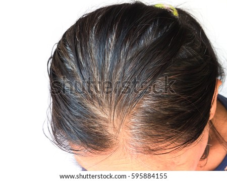 Closeup grey hair and loss in old woman with white background