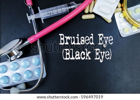 Bruised Eye word, medical term word with medical concepts in blackboard and medical equipment. 