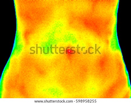 Thermographic image of the abdomen of a woman showing different temperature in a range of colors from blue showing cold to red showing hot which can indicate inflammation. Royalty-Free Stock Photo #598958255