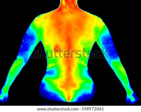 Thermographic image of the back of a woman showing complete spine with photo showing different temperatures in range of colors, blue showing cold, red showing hot which can indicate joint inflammation Royalty-Free Stock Photo #598972061