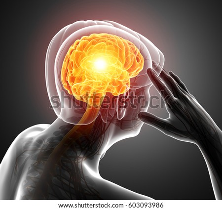 3d Illustration of Male Feeling Headache