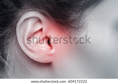 Close up of female ear with source of pain Royalty-Free Stock Photo #604172222