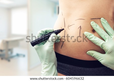 plastic surgeon marking womans body for surgery Royalty-Free Stock Photo #604596632