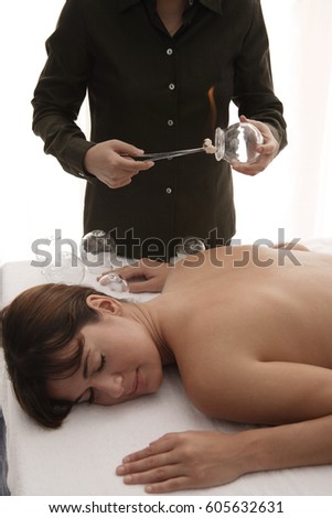 therapist preparing cupping treatment