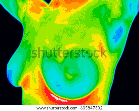 Thermographic image of a chest showing different temperatures from blue showing cold to red showing hot which can indicate inflammation and infection. Image showing healthy breast with no growths. Royalty-Free Stock Photo #605847302