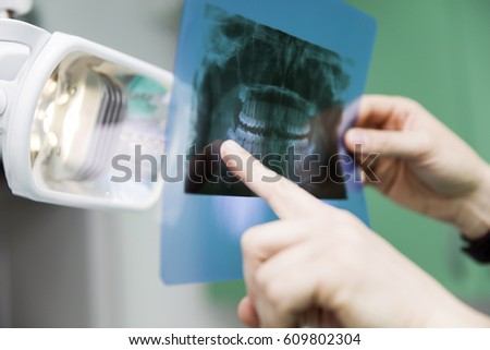 Dentist analyzing x-ray of teeth