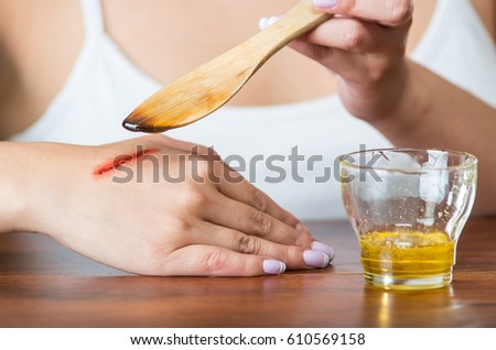 Young model sitting down using wooden knife applying honey to bloody scar on hand
