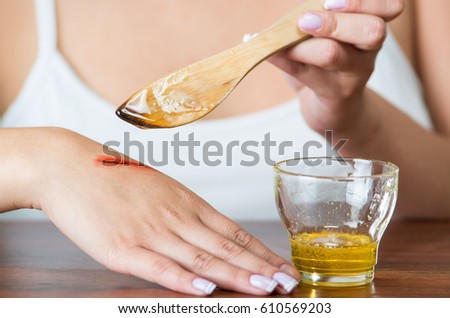 Young model sitting down using wooden knife applying honey to bloody scar on hand Royalty-Free Stock Photo #610569203