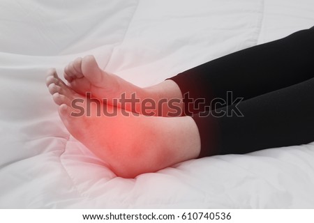 Foot swelling during pregnancy.,Swollen feet Royalty-Free Stock Photo #610740536