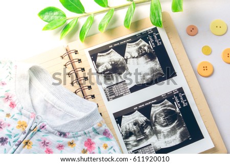 Ultrasound scan film with notebook on white table background.