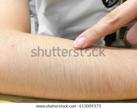 skin in close-up view with swell hears on it,drops arm hairs