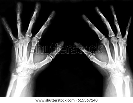 hands in X-rays